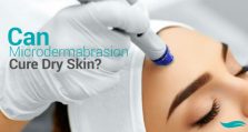 Can Microdermabrasion Cure Dry Skin?