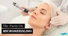 The Facts On Microneedling