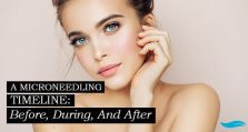A Microneedling Timeline: Before, During, And After