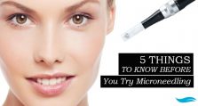 5 Things To Know Before You Try Microneedling